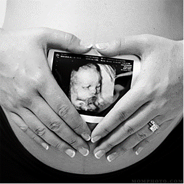 Uj Health Sciences Students Boost Antenatal Care